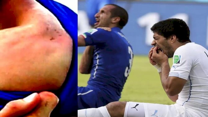 Chiellini Holds No Suarez Grudge Despite 2014 World Cup Bite